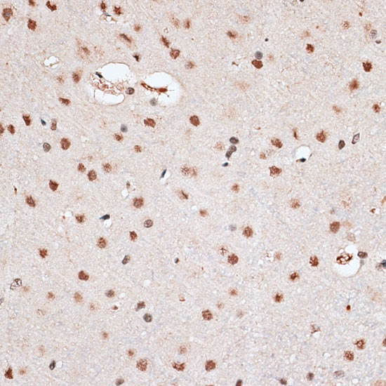 RBM3 Rabbit polyclonal antibody