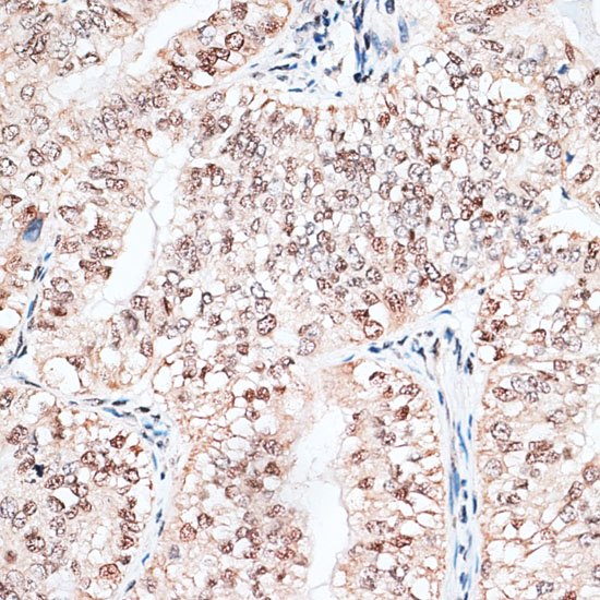 RBM3 Rabbit polyclonal antibody
