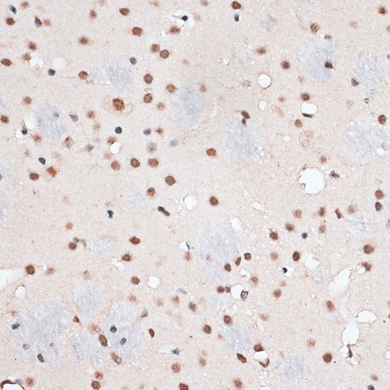RBM3 Rabbit polyclonal antibody