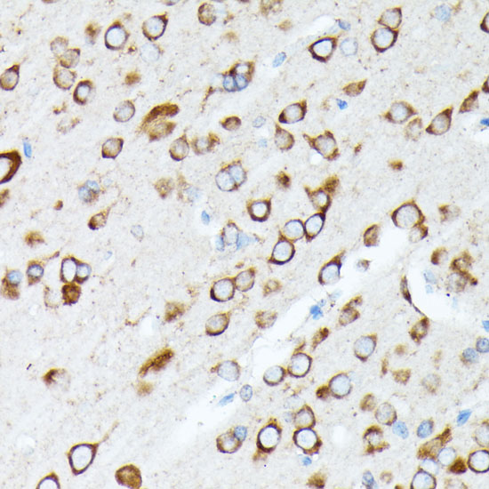 RPL7 Rabbit polyclonal antibody
