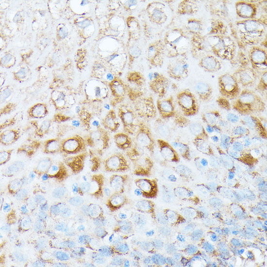 RPL7 Rabbit polyclonal antibody