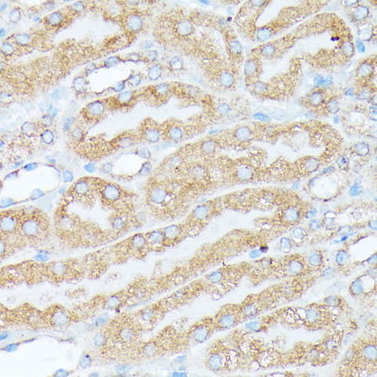 RPL7 Rabbit polyclonal antibody