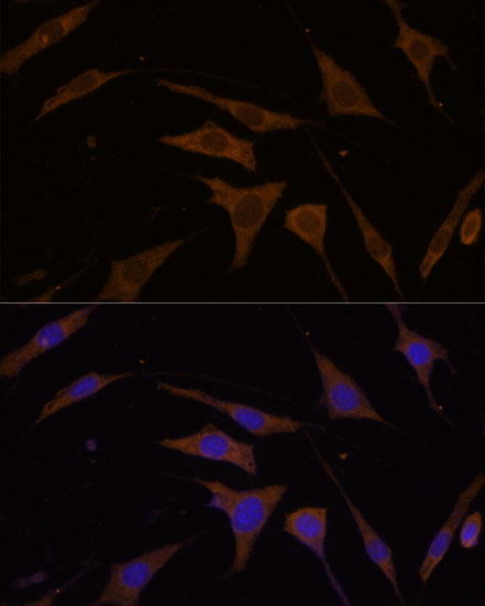 RPL7 Rabbit polyclonal antibody