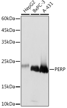 PERP Rabbit monoclonal antibody
