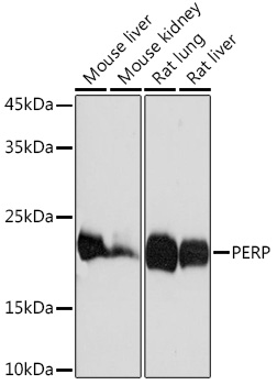 PERP Rabbit monoclonal antibody