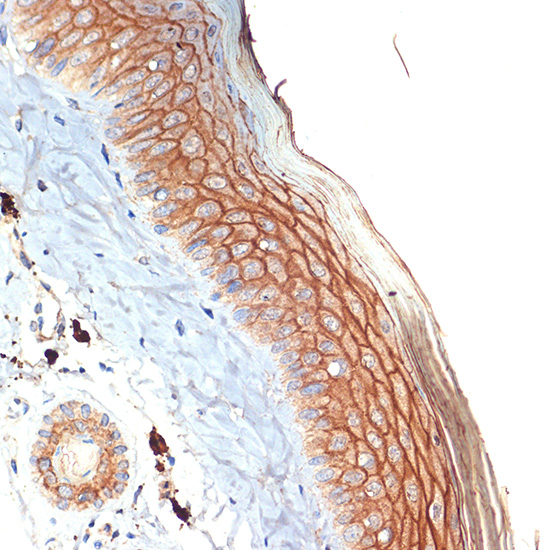 PERP Rabbit monoclonal antibody