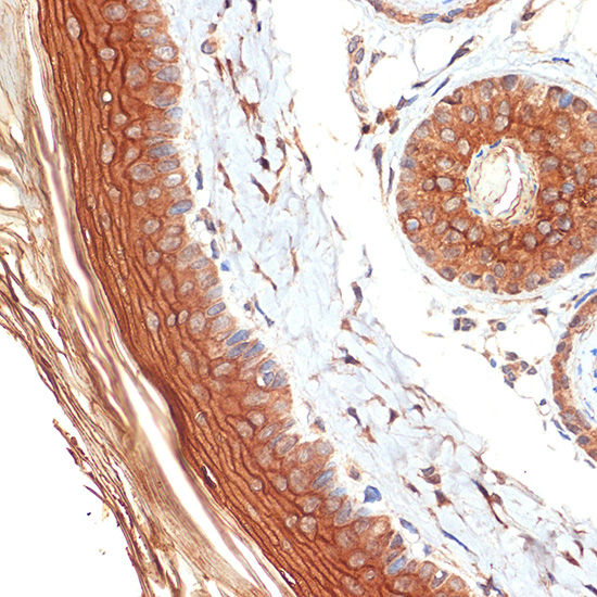 PERP Rabbit monoclonal antibody