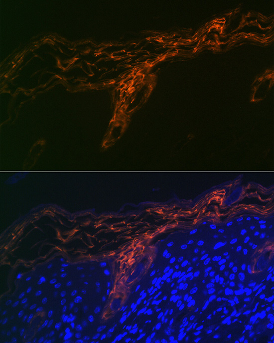PERP Rabbit monoclonal antibody
