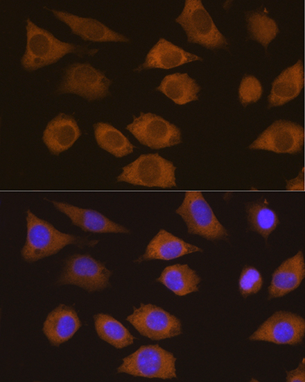 [KO Validated] CSDE1 Rabbit polyclonal antibody