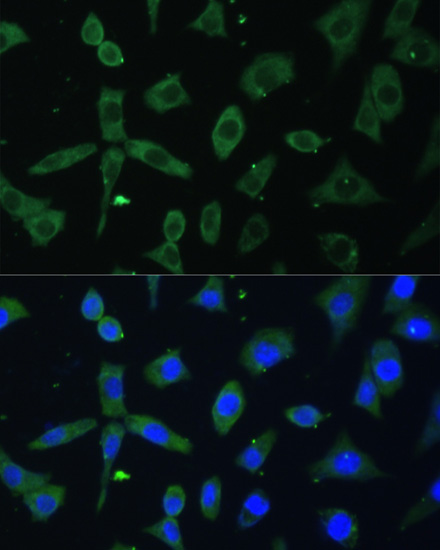 EIF3D Rabbit polyclonal antibody