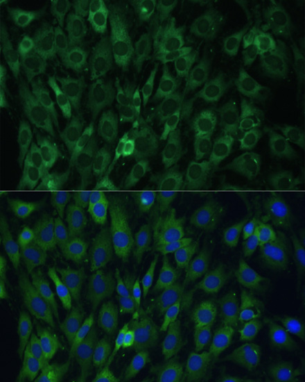 EIF3D Rabbit polyclonal antibody