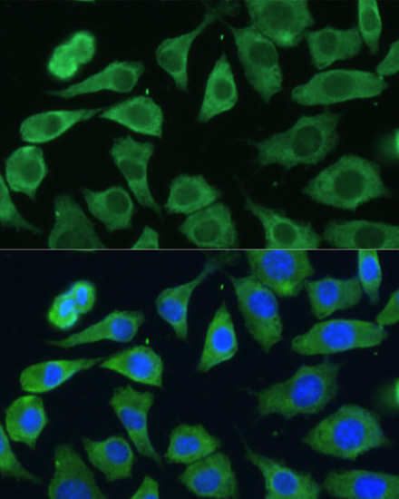 EIF3D Rabbit polyclonal antibody