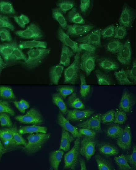 EIF3D Rabbit polyclonal antibody