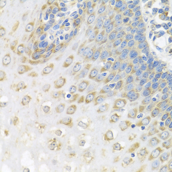 PABPC4 Rabbit polyclonal antibody