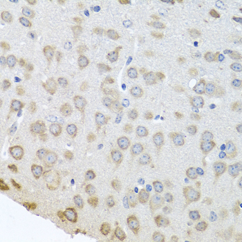 PABPC4 Rabbit polyclonal antibody