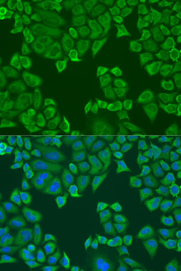 PABPC4 Rabbit polyclonal antibody