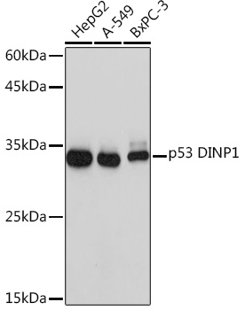 p53 DINP1 Rabbit monoclonal antibody