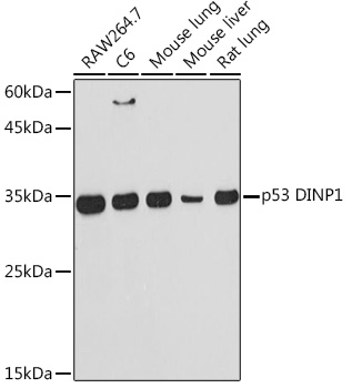 p53 DINP1 Rabbit monoclonal antibody