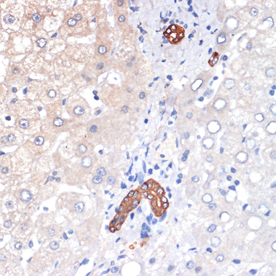 p53 DINP1 Rabbit monoclonal antibody