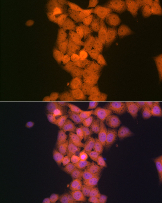 p53 DINP1 Rabbit monoclonal antibody