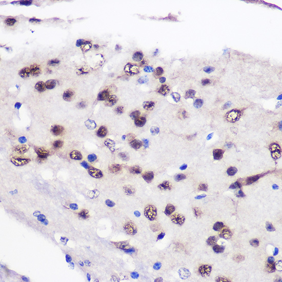 CELF1 Rabbit polyclonal antibody