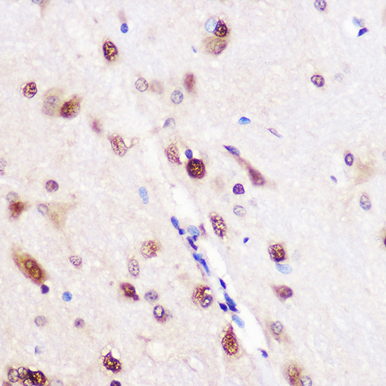 CELF1 Rabbit polyclonal antibody