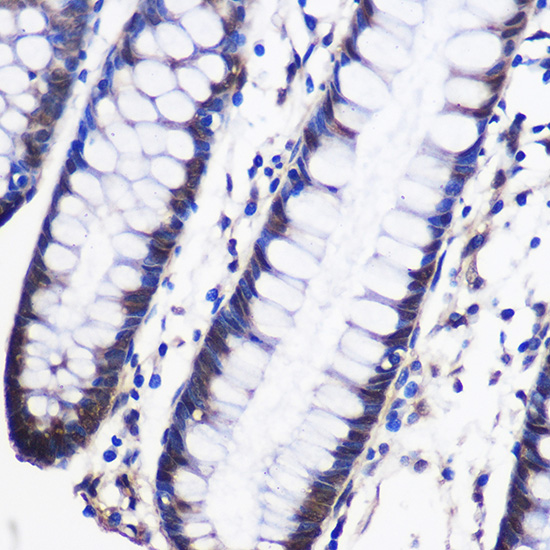 CELF1 Rabbit polyclonal antibody
