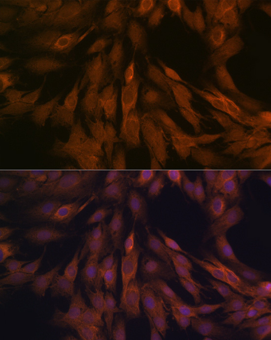 ULK3 Rabbit monoclonal antibody