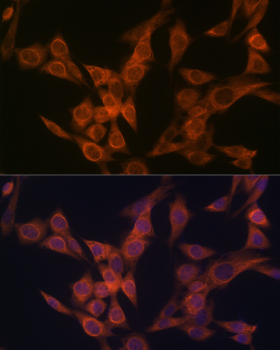 ULK3 Rabbit monoclonal antibody