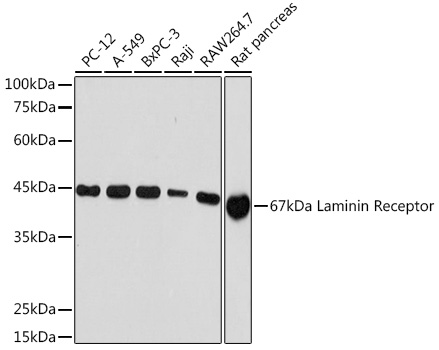 67kDa Laminin Receptor Rabbit monoclonal antibody
