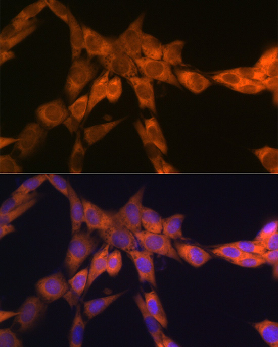 67kDa Laminin Receptor Rabbit monoclonal antibody