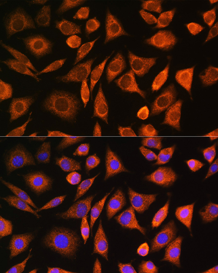 CNOT1 Rabbit polyclonal antibody