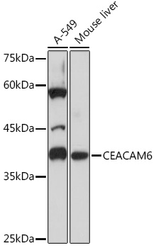 CEACAM6 Rabbit monoclonal antibody