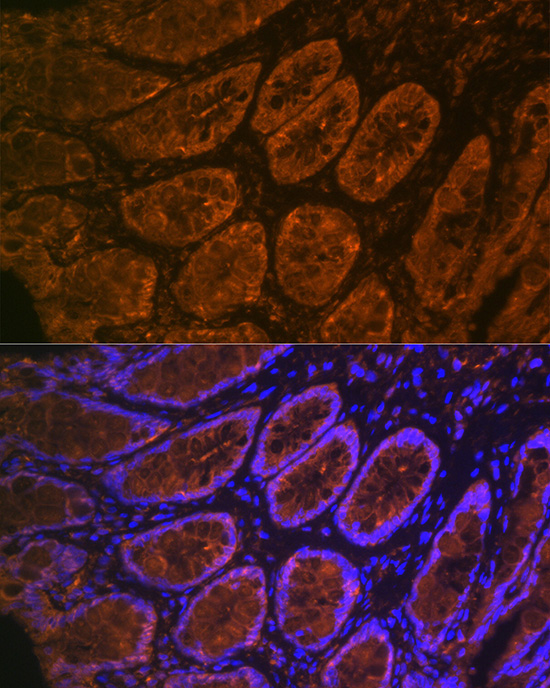 CEACAM6 Rabbit monoclonal antibody
