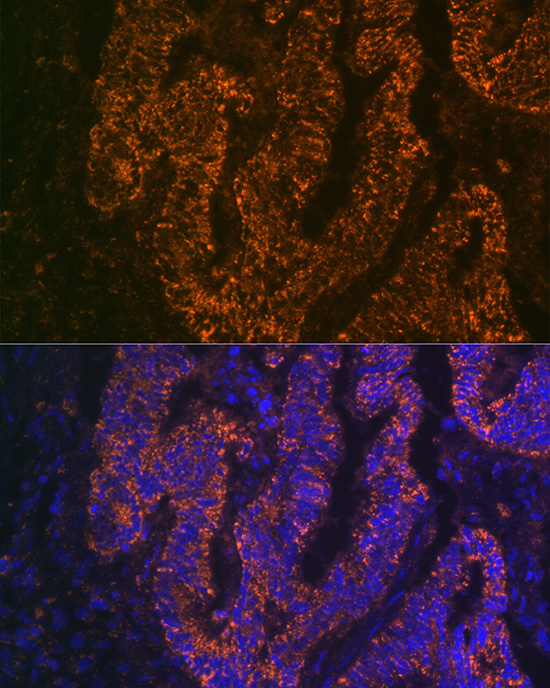 CEACAM6 Rabbit monoclonal antibody