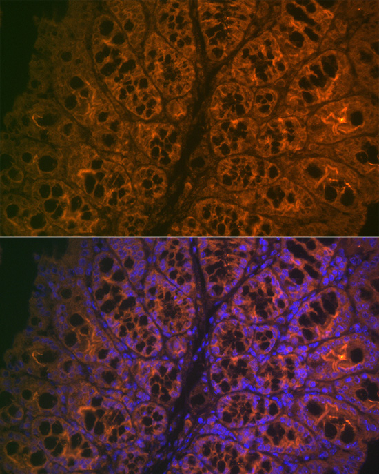 CEACAM6 Rabbit monoclonal antibody