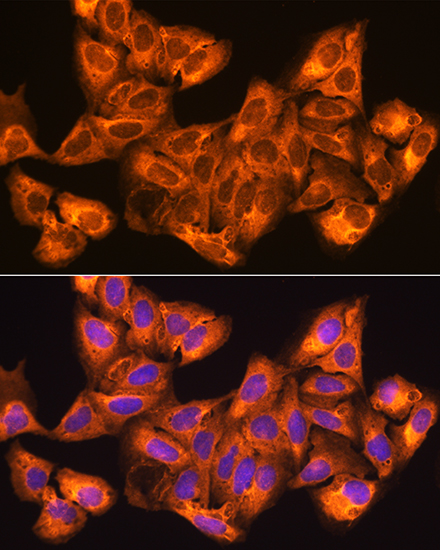 ZCCHC11 Rabbit polyclonal antibody
