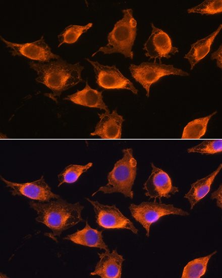 ZCCHC11 Rabbit polyclonal antibody