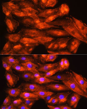 ZCCHC11 Rabbit polyclonal antibody