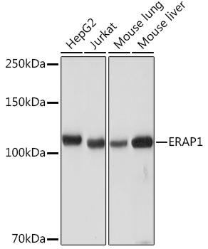 ERAP1 Rabbit monoclonal antibody