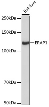 ERAP1 Rabbit monoclonal antibody