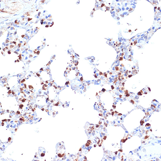 ERAP1 Rabbit monoclonal antibody