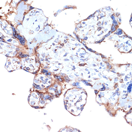 ERAP1 Rabbit monoclonal antibody