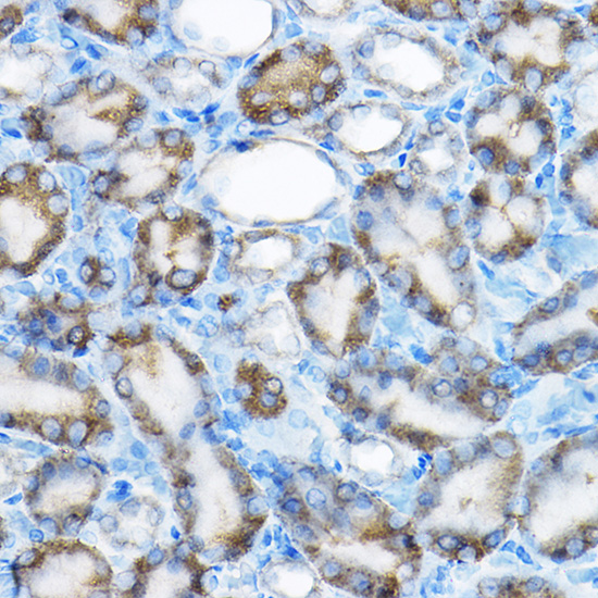 MRPL13 Rabbit polyclonal antibody