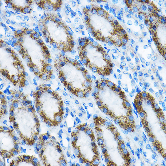 MRPL13 Rabbit polyclonal antibody