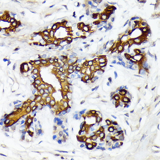 CYP26A1 Rabbit monoclonal antibody