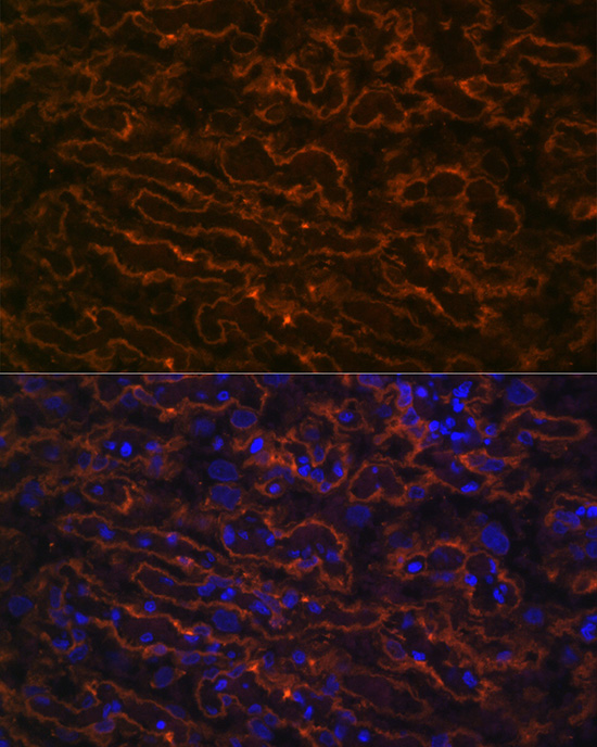 CYP26A1 Rabbit monoclonal antibody