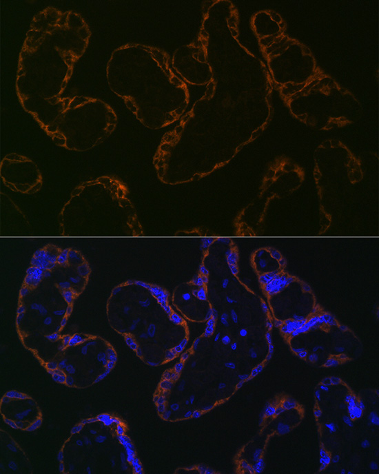 CYP26A1 Rabbit monoclonal antibody