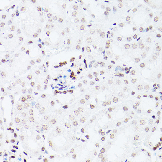 NSUN5 Rabbit polyclonal antibody