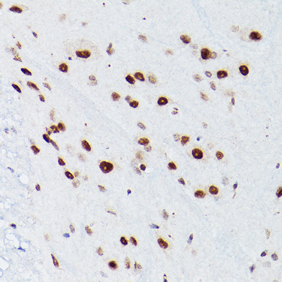 NSUN5 Rabbit polyclonal antibody
